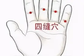 经外奇穴-四缝穴图片