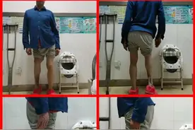 甘州区人民医院：华西医院“康鹏德工作室”让群众少跑路、看好病！图片