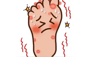 个人如何有效持久的防治脚气图片