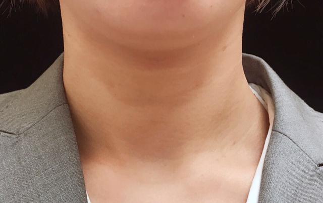 身体乳什么年龄