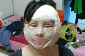 整容高达200次，公开质疑李小璐博眼球，为了变美"断骨"成残疾图片