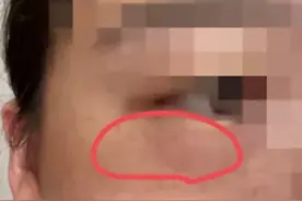 冲上热搜！“再也不敢关灯玩手机了”图片