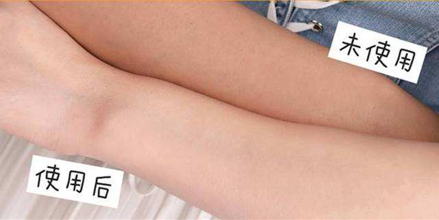 身体乳长毛是为什么