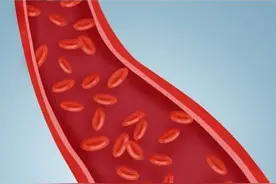 下肢血管堵，走路就会一瘸一拐图片