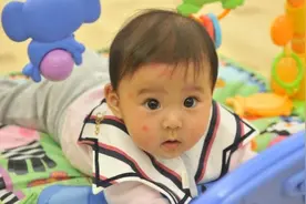 小宝宝被蚊子叮了个大包？别着急，去厨房找找三种东西，有奇效图片