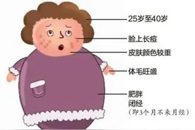 爱美女子如何能忍受自己多毛呢？“多毛症”的前世今生，请看此文图片