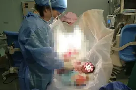 奇妙的缘份！助产士节，宁波鄞州一位助产士，为同名同姓的产妇接生图片