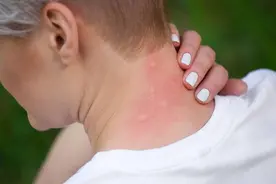 颈椎病一旦出现，症状没想象中简单，小心吞咽困难，血压升高图片