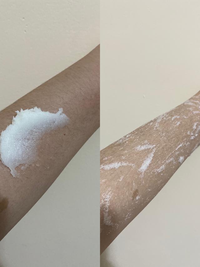 去鸡皮疙瘩毛囊的小妙招