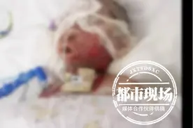 悲痛！6岁女童在家中吃火锅被酒精重度烧伤，连续8天昏迷不醒图片