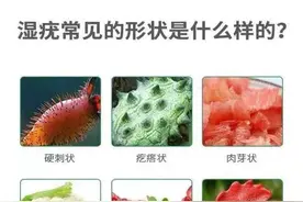 隐私部位长出菜花状、鸡冠样疣体！祸根是谁？皮肤科专家给出答案图片