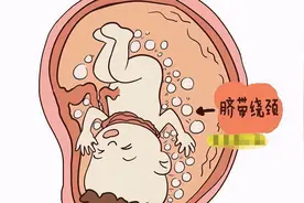 孕期晚上睡觉老是翻来覆去，宝宝会发育不好，或者脐带绕颈吗图片
