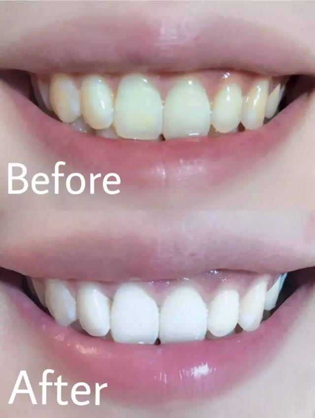 涓€娆惧彿绉?鈥滀笂甯濆垱閫犵殑鐗欒啅鈥?姊呭ゥ鍖婚櫌閮芥槸鎸囧畾瀹?缃戝弸锛氫竾鑳? onerror=