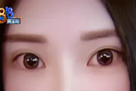 整形后，经常流眼泪，频繁眨眼睛……图片