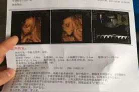 孕检B超照片，照出“睡美人”，原来宝宝在子宫“小黑屋”这么忙图片