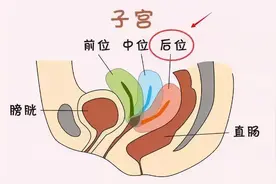 子宫后位对怀孕有影响吗？速速get子宫后位的备孕技巧图片