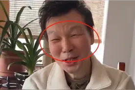 原来他突然消失，不是被“封杀”，而是因为生病了图片