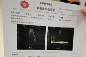 我的经历剖腹产详细过程，给各位即将生产的妈妈一个参考图片