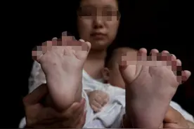 刚满4个月的男娃，两只脚都有8个脚趾，两只手分别7、8个手指图片