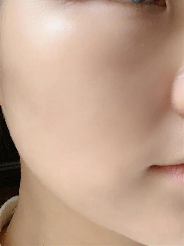 刷酸王者搭配，趁早远离油痘肌