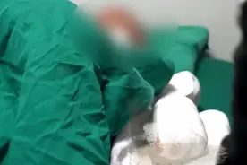 被父亲烫伤双手的茂名男童经4次手术已出院！需接受心理干预图片