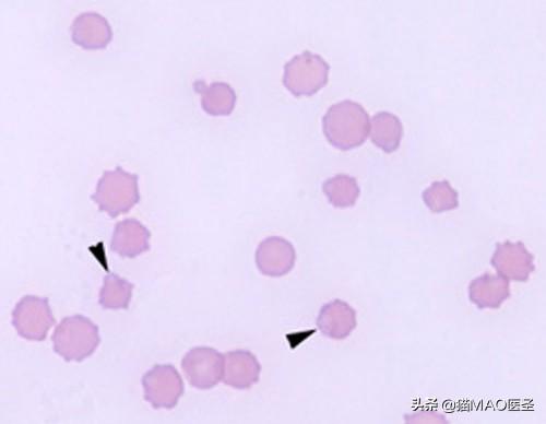 猫血液疾病｜猫吃家里某些物质，引发贫血，即亨氏小体溶血性贫血