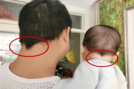 头发会“出卖”一个人的性格？孩子头发“老鼠尾”，暗示性格特征图片