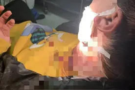 事发大连！男子遛狗时，一陌生男子突然袭击致其颈部缝了12针图片