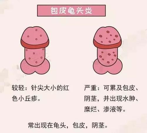 最近丁丁老痒痒的是怎么回事？