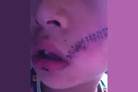 男孩打开冰箱门发生爆炸，脸上缝了38针，夏天这几样东西别放冰箱图片