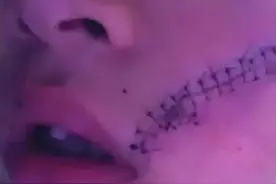 男孩打开冰箱门发生爆炸，脸上缝了38针，夏天这几样东西别放冰箱图片