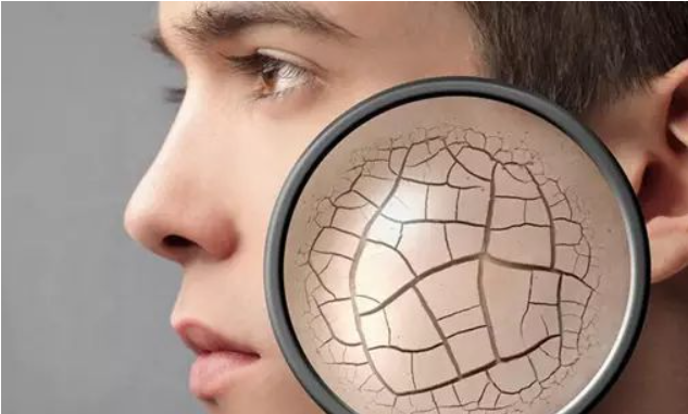 鐨偆灞忛殰鍙楁崯鎬庝箞鍔烇紵鎶よ偆鍋氬ソ杩欏嚑姝ユ槸鍏抽敭锛屽潥鎸佹墠鏈夋晥鍝? onerror=