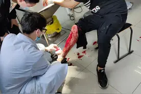 西安男子不慎打破玻璃门，小伤口却导致休克！医生提醒，伤口处理要遵医嘱图片