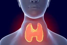 张丽医生告诉你甲状腺肿的治疗需要什么？图片