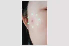 小偏方去斑，亲身体验第七天，看看效果咋样？图片