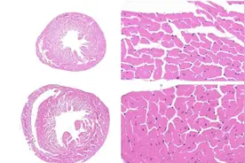 心肌肥厚(CH)小鼠模型的建模方法图片