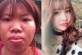 越南女孩花数十万整容，嫁给富二代，生子后事情败露惨离婚图片