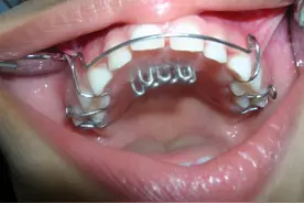 宝宝爱吃手要紧吗？别慌，到这个程度才需要干预图片