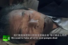 人体含水78%，这个数据是谁测量的？答案让人心如刀割：731部队图片