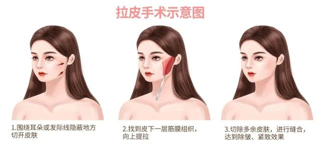 面部年轻化的最好方法 2026年面部年轻化的最好方法吃什么最快恢复