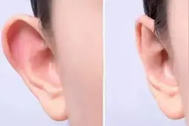 科普小文章：招财耳真的能招财吗？图片