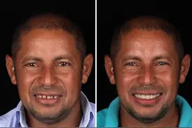 好心牙医为穷人免费补牙：原来牙齿整齐对颜值影响这么大图片