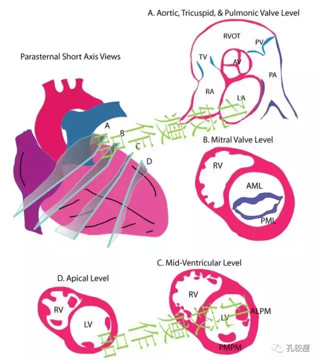 胸骨旁系列短轴切面示意图探头放置及系列短轴的超声切面(依次为主