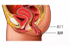 [科普知识]肛门直肠动力检查图片