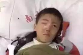 不到30分钟，男孩的整颗眼睛没有了，这东西你家常有父母别轻视了图片
