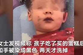 孩子吃蛋糕手脸沾上黑色素两天没洗掉 店家：是食用色素 有合格检测报告图片