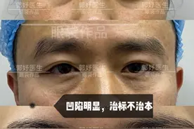 想去眼袋，不做眶隔释放可以吗？图片