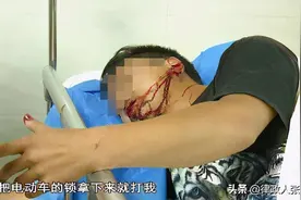 外卖小哥持U型锁怒砸司机头部，律师：他面对的不再是交通事故图片