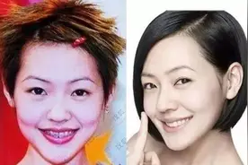 小S“换头术”：你不是长得丑，只是牙不美图片