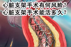 心脏放了支架后，会不会影响人的“寿命”？今天告诉你明确的答案图片